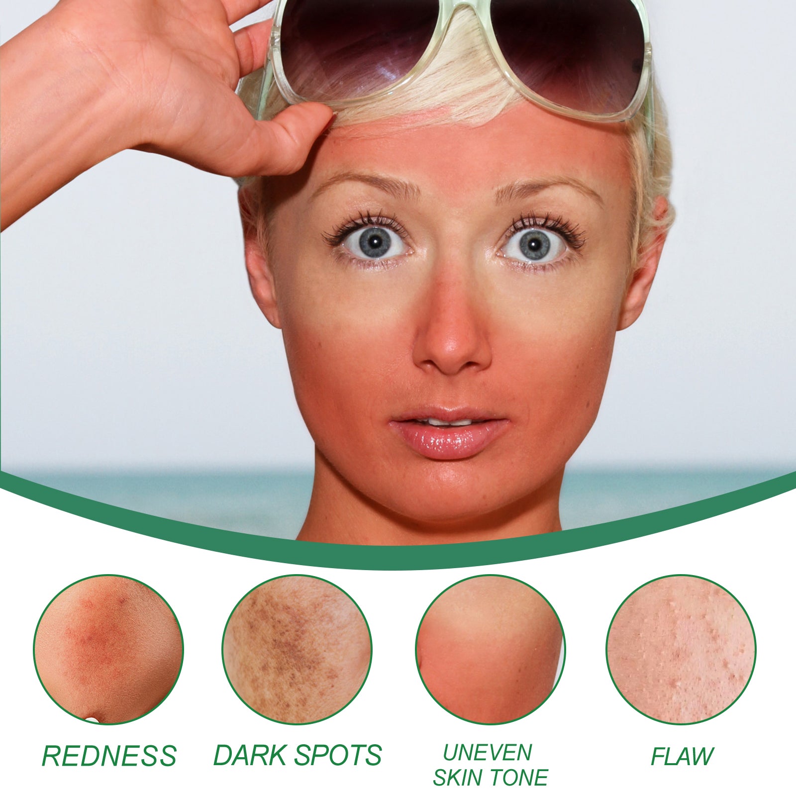 West&Month Color Correcting Care Cream For Diminishing Spots, Post-sun Recovery, Nourishing, And Enhancing The Skin's Beauty